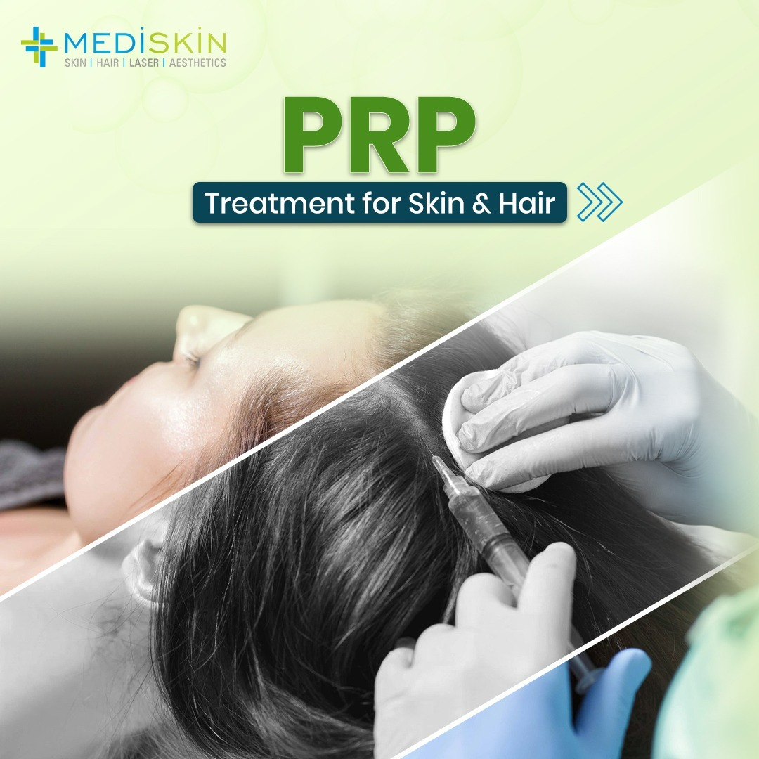 PRP Treatment at MediSkin – Dr. Venkatesh Purohit